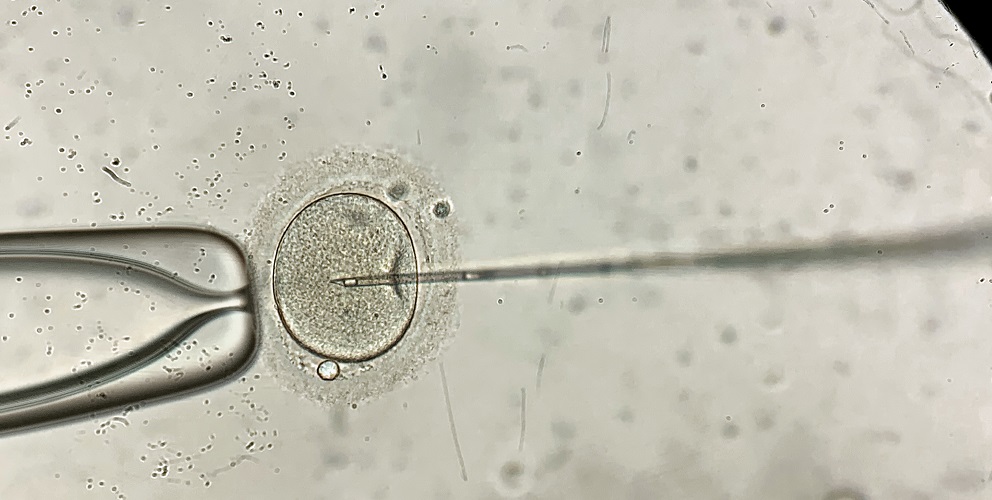 IVF microscope