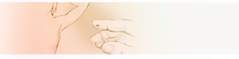 Practical Implanon NXT training