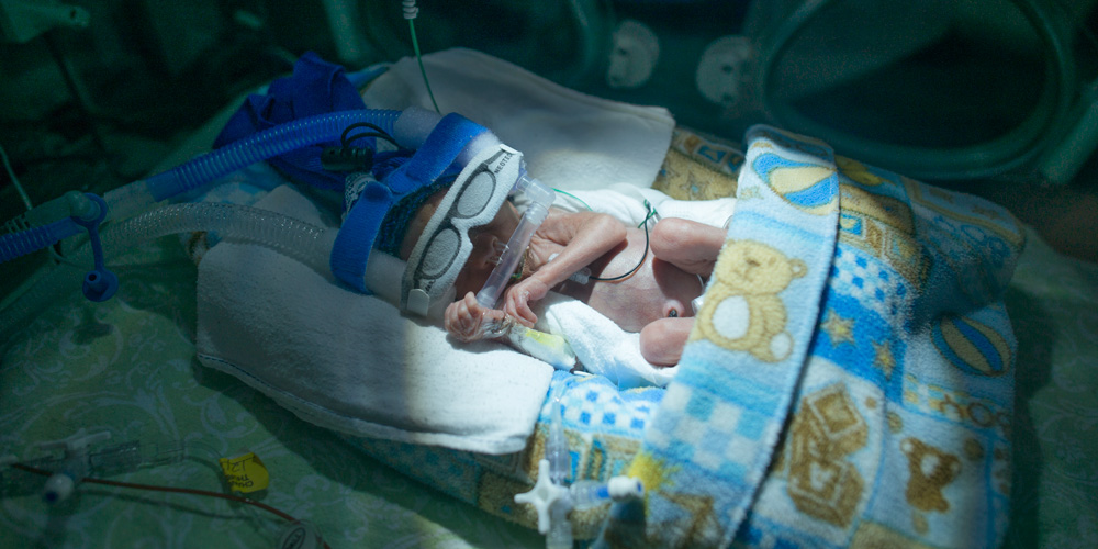 Premature baby