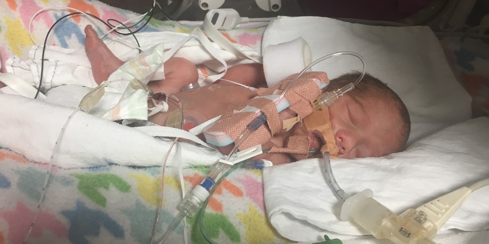 Baby Willow in NICU