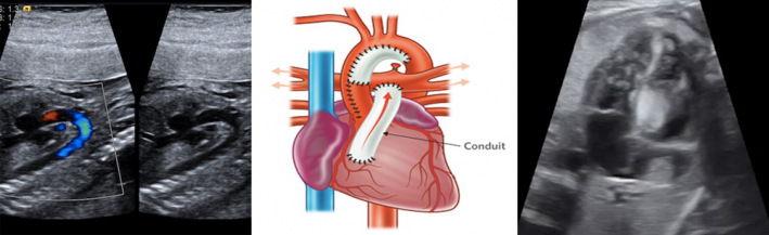 Fetal Cardiology Conference