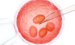 Public Fertility Care